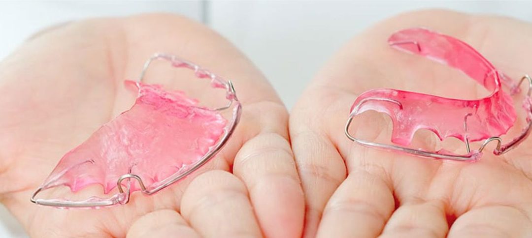 En Clínica Kaizen te enseñamos los diferentes tipos de retenedores