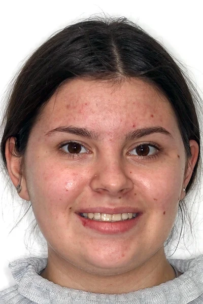 Fotografía de Elisabetta, paciente de Clínica Kaizen