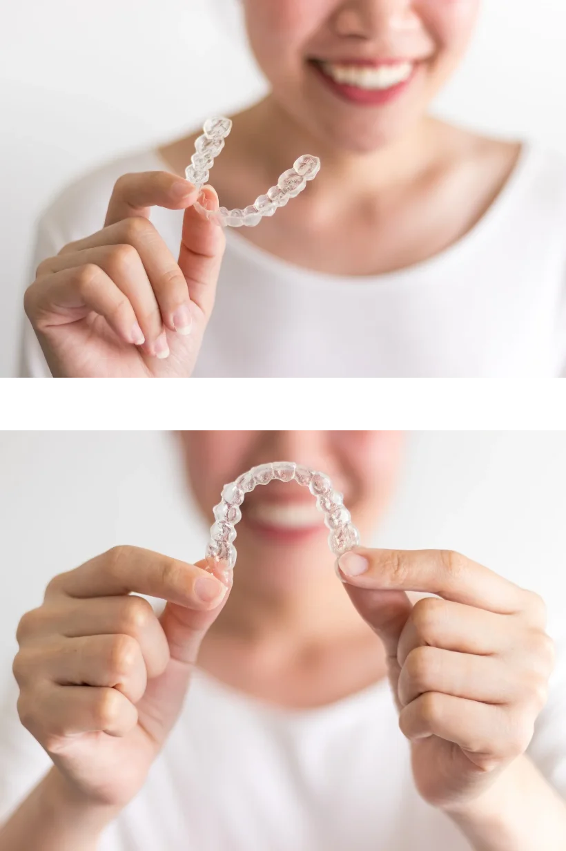 Fotografía doble de una mujer sujetando un alineador transparente Invisalign