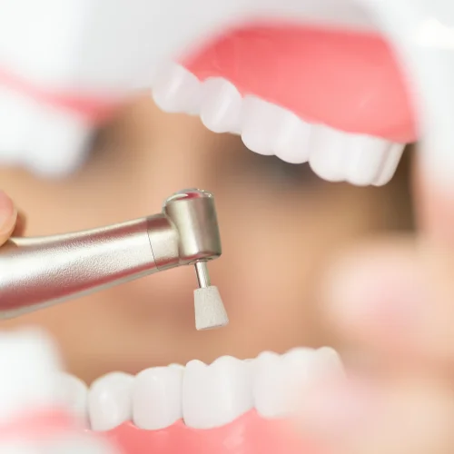 Fotografía de instrumental dental de pulido sobre dentadura