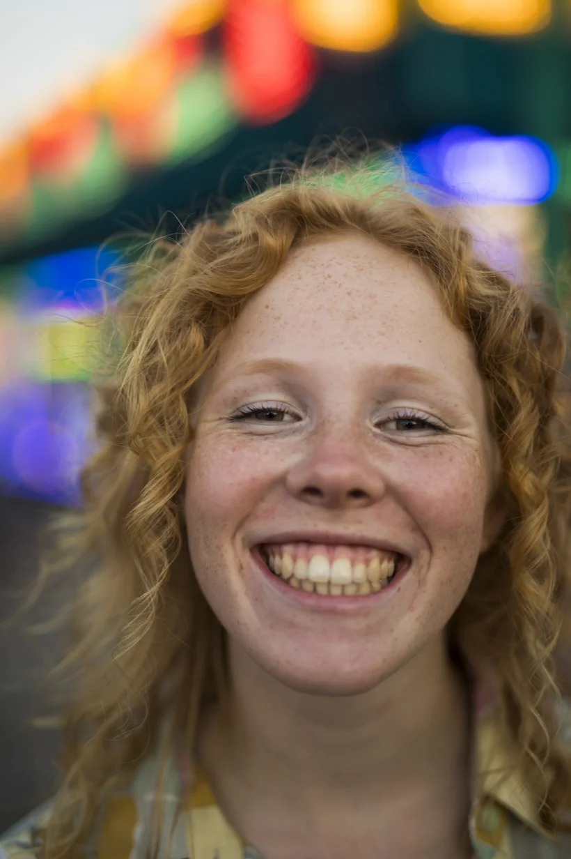 Fotografía de una mujer sonriendo mostrando las encías